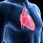 Cos’è l’endocardite